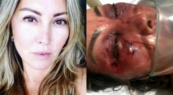 Empresária é espancada por advogado que conheceu na internet