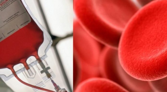 Veja quais são os tipos sanguíneos que influenciam risco de AVC